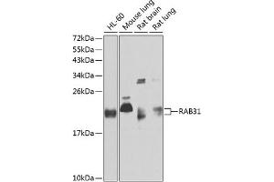 Western blot analysis of extracts of various cell lines, using R antibody (ABIN6128595, ABIN6146569, ABIN6146571 and ABIN6220321) at 1:1000 dilution. (RAB31 anticorps  (AA 1-195))
