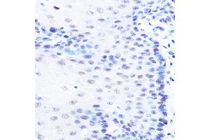 Immunohistochemistry of paraffin-embedded human esophageal using MITF Rabbit mAb (ABIN7268511) at dilution of 1:100 (40x lens).