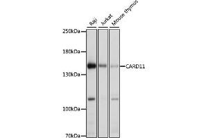 Western blot analysis of extracts of various cell lines, using C antibody (ABIN6127550, ABIN6137939, ABIN6137940 and ABIN6222956) at 1:1000 dilution. (CARD11 anticorps  (AA 985-1154))