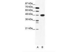 Image no. 1 for anti-Enolase 1 (ENO1) (N-Term) antibody (ABIN202517) (ENO1 anticorps  (N-Term))