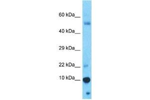 Host:  Rabbit  Target Name:  PAGE4  Sample Type:  Thymus Tumor lysates  Antibody Dilution:  1. (PAGE4 anticorps  (N-Term))