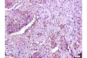 Formalin-fixed and paraffin embedded rat heart labeled with Rabbit Anti TLR4/CD284 Polyclonal Antibody, Unconjugated (ABIN736491) at 1:200 followed by conjugation to the secondary antibody and DAB staining