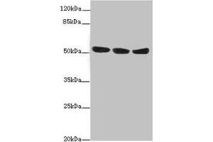 Western blot All lanes: KYNU antibody at 1. (KYNU anticorps  (AA 1-307))