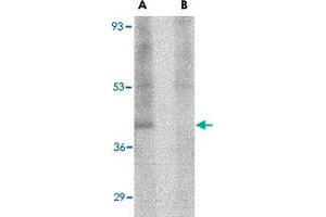 Western blot analysis of RIMS3 in human brain tissue lysate with RIMS3 polyclonal antibody  at 1 ug/mL in the (A) absence and (B) presence of blocking peptide. (RIMS3 anticorps  (N-Term))