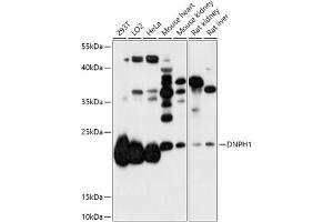 Western blot analysis of extracts of various cell lines, using DNPH1 antibody (ABIN7266384) at 1:1000 dilution. (RCL anticorps  (AA 1-174))