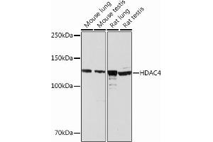 Western blot analysis of extracts of various cell lines, using HD Rabbit mAb (ABIN6132653, ABIN6147718, ABIN6147719 and ABIN7101423) at 1:1000 dilution. (HDAC4 anticorps)