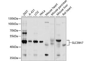 Western blot analysis of extracts of various cell lines, using SLC39 antibody (ABIN1682785, ABIN3017729, ABIN3017730 and ABIN6220217) at 1:1000 dilution.