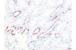 Immunohistochemistry of paraffin-embedded rat kidney using PDHB Rabbit mAb (ABIN7269772) at dilution of 1:100 (40x lens). (PDHB anticorps)