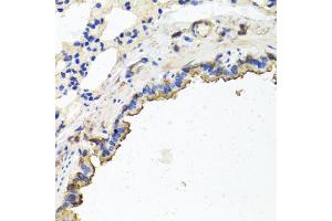 Immunohistochemistry of paraffin-embedded rat lung using TUBB8 antibody (ABIN5974843) at dilution of 1/100 (40x lens). (Tubulin, beta 8 anticorps)