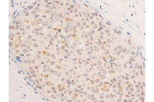 ABIN6267066 at 1/200 staining human gastric tissue sections by IHC-P.