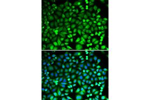 Immunofluorescence analysis of MCF-7 cells using PSMB2 antibody (ABIN6291444).