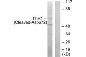 Western blot analysis of extracts from Jurkat cells, treated with etoposide 25uM 24h, using ITIH1 (Cleaved-Asp672) Antibody. (ITIH1 anticorps  (Cleaved-Asp672))