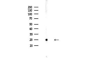 Western blot analysis of lysates from COLO205 cells, using Mob3C Antibody at 1/1000 dilution.