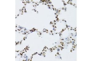 Immunohistochemistry of paraffin-embedded mouse lung using NFKB2 Antibody.