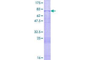 Image no. 1 for Mitogen-Activated Protein Kinase Kinase 7 (MAP2K7) (AA 1-426) protein (GST tag) (ABIN1310191)