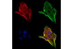 ABIN6260791 and ABIN6273208 staining Hela cells by IF/ICC. (CHCHD4 anticorps  (N-Term))