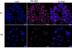 anti-Translocase of Inner Mitochondrial Membrane 50 Homolog (TIMM50) antibody