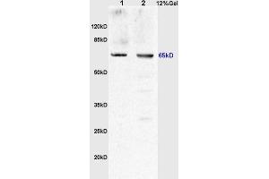 L1 rat kidney lysates, L2 human kidney carcinoma lysates probed (ABIN678473) Anti MCKD2/UMOD Polyclonal, Unconjugated at 1:200 in 4 °C.