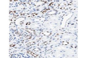 ABIN6266610 at 1/100 staining human kidney tissue sections by IHC-P.