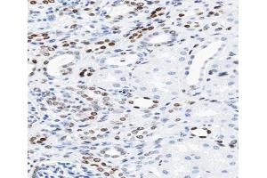 ABIN6266610 at 1/100 staining human kidney tissue sections by IHC-P. (KAT2B anticorps  (C-Term))