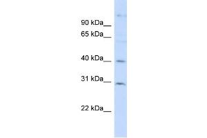 WB Suggested Anti-FAM50B Antibody Titration: 0. (FAM50B anticorps  (N-Term))