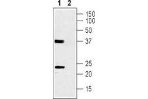Western blot analysis of rat skeletal muscle lysate: - 1. (CACNG1 anticorps  (1st Extracellular Loop))