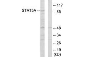 Western blot analysis of extracts from 293 cells, using STAT5A Antibody. (STAT5A anticorps  (AA 386-435))