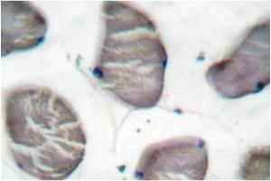 Image no. 1 for anti-Actin, alpha 1, Skeletal Muscle (ACTA1) antibody (ABIN265299) (Actin anticorps)