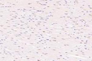 Immunohistochemistry analysis of paraffin-embedded rat heart using,SRFBP1 (ABIN7075579) at dilution of 1: 2000 (SRFBP1 anticorps)
