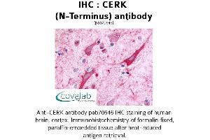 Image no. 1 for anti-Ceramide Kinase (CERK) (Extracellular Domain), (N-Term) antibody (ABIN1733020) (CERK anticorps  (Extracellular Domain, N-Term))