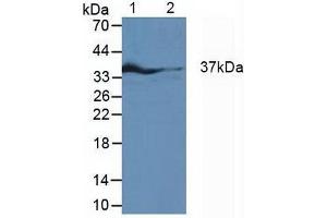Western blot analysis of (1) Rat Fetal Rat Tissue, (2) Rat Heart Tissue and (3) Rat Placenta Tissue. (IRF1 anticorps  (AA 11-276))