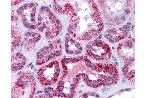 Immunohistochemistry (IHC) image for anti-Tumor Protein P53 (TP53) (N-Term) antibody (ABIN2779317)