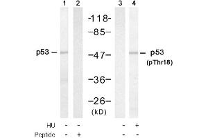 Image no. 1 for anti-Tumor Protein P53 (TP53) (Thr18) antibody (ABIN319304) (p53 anticorps  (Thr18))