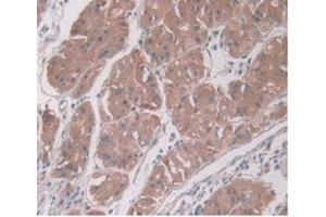 DAB staining on IHC-P Samples:Human Stomach Tissue) (PAI1 anticorps  (AA 25-402))