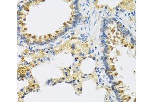 Immunohistochemistry of paraffin-embedded Rat lung using HRG Polyclonal Antibody at dilution of 1:100 (40x lens). (HRG anticorps)