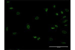 Immunofluorescence of monoclonal antibody to MEOX1 on HeLa cell. (MEOX1 anticorps  (AA 82-170))