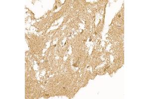 Immunohistochemistry of paraffin-embedded human brain using RC Rabbit pAb (ABIN6129452, ABIN6146811, ABIN6146812 and ABIN6220955) at dilution of 1:150 (40x lens).