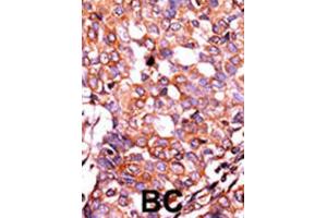 Immunohistochemistry (IHC) image for anti-LPR1 (pSer4520) antibody (ABIN3001761) (LPR1 (pSer4520) anticorps)