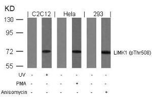 Western blot analysis of extracts from UV-treated C2C12, PMA-treated Hela and anisomycin-treated 293 cells using LIMK1(Phospho-Thr508) Antibody. (LIM Domain Kinase 1 anticorps  (pThr508))