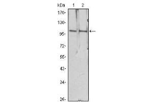 Western Blot showing HDAC4 antibody used against Hela (1), Jurkat (2) cell lysate. (HDAC4 anticorps)