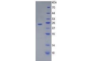 SDS-PAGE of Protein Standard from the Kit  (Highly purified E.