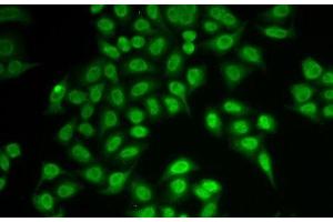 Immunofluorescence analysis of MCF-7 cells using PSMB9 Polyclonal Antibody (PSMB9 anticorps)