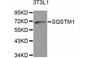 Western blot analysis of extracts of 3T3-L1 cells, using SQSTM1 antibody. (SQSTM1 anticorps)