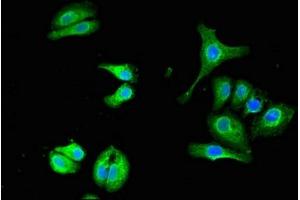 anti-Ubiquilin 1 (UBQLN1) (AA 1-300) antibody