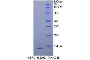 SDS-PAGE analysis of Human uPAR Protein. (PLAUR Protéine)