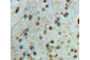 Used in DAB staining on fromalin fixed paraffin-embedded brain tissue (SRPK2 anticorps  (AA 380-617))