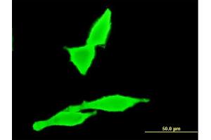Immunofluorescence of monoclonal antibody to CNR2 on HeLa cell. (CNR2 anticorps  (AA 302-360))