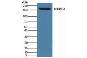 Western blot analysis of Human Serum. (SLC12A3 anticorps  (AA 867-1024))