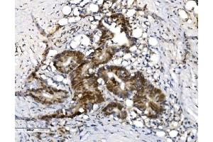 IHC analysis of VPRBP/DCAF1 using anti-VPRBP/DCAF1 antibody (ABIN7599063). (DDB1 and CUL4-Associated Factor 1 (DCAF1) (AA 1-195) anticorps)