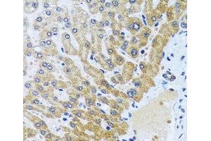 Immunohistochemistry of paraffin-embedded Human liver using CPA6 Polyclonal Antibody at dilution of 1:100 (40x lens). (CPA6 anticorps)